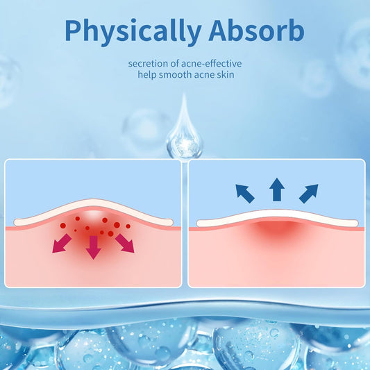 Zavlyra Pimple Patches for Face – Hydrocolloid Acne Spot Treatment