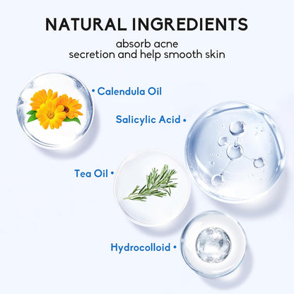 Zavlyra Pimple Patches for Face – Hydrocolloid Acne Spot Treatment